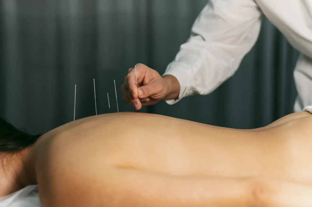 acupuntura en illescas